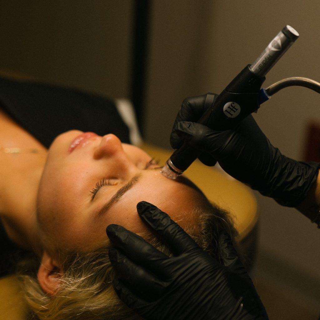 jola hydrafacial HydraFacial performed before holiday events for glowing skin.