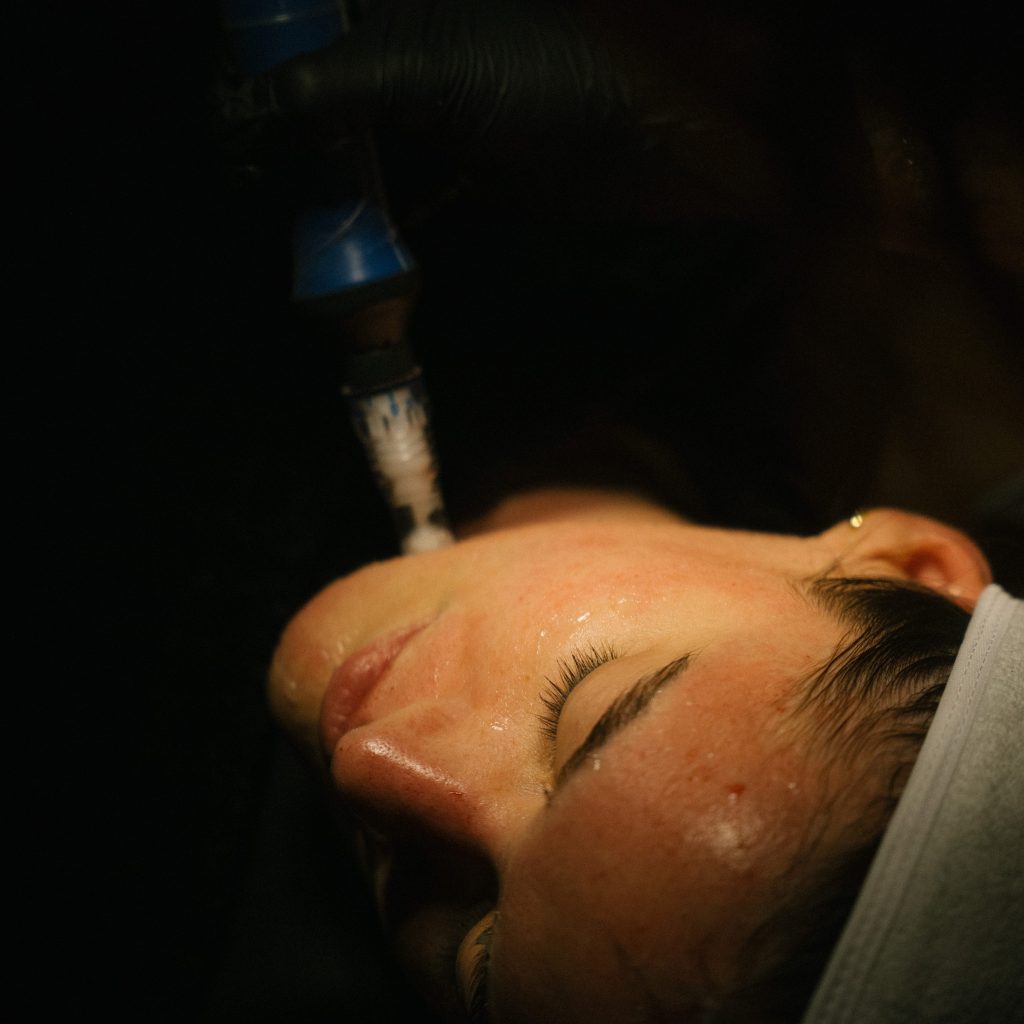 jola dallas - pigmentation jola dallas - pigmentation